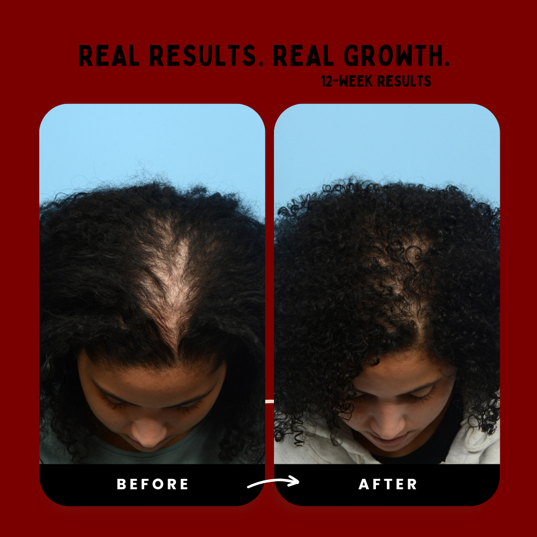 Hair Revival Comb™