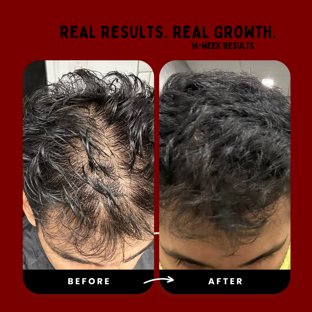 Hair Revival Comb™