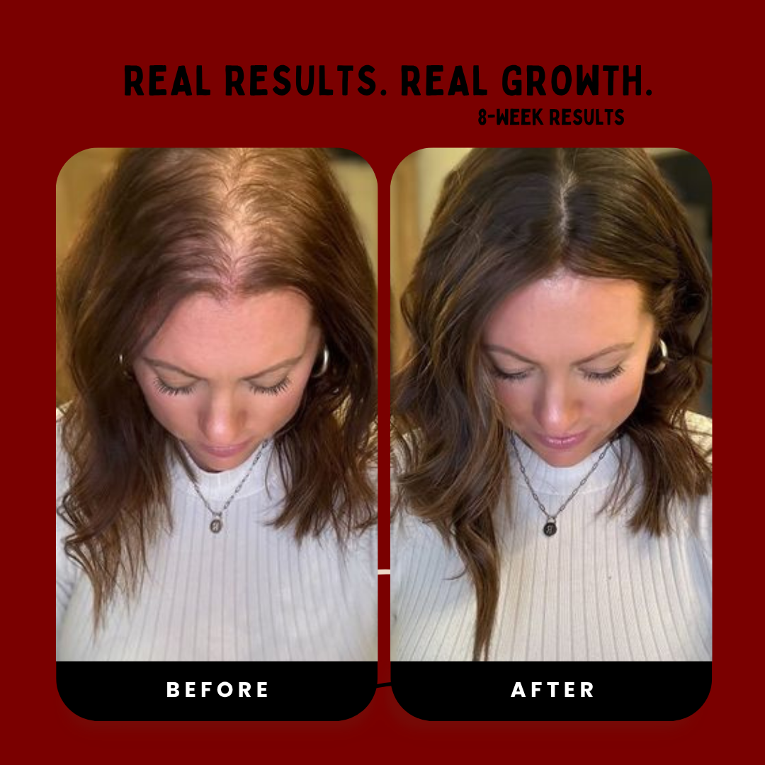Hair Revival Comb™