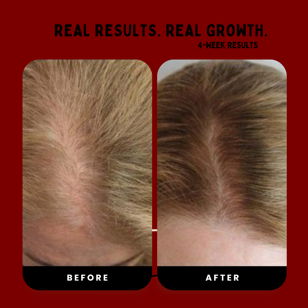 Hair Revival Comb™