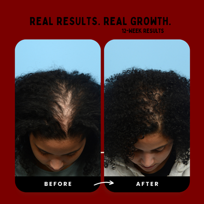 Hair Revival Comb™